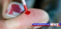 Малаас хүнд халдварладаг шинэ өвчнөөс сэрэмжлүүлж байна
