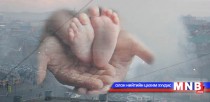 Ургийн гажгийг эрт илрүүлэх боломжтой 