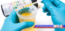 Өрхийн эмнэлгүүдэд шээсний шинжилгээ авдаг болов