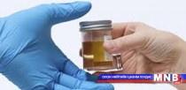 Шээсний иж бүрэн шинжилгээ авах оношлуур ирэх сараас өрхийн эмнэлгүүдэд хуваарилагдана 
