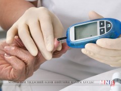 “Чихрийн шижинтэй тэмцэх” дэлхийн өдөр тохиож байна