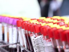 Хепатитийн В, С вирүсийн илрүүлэг шинжилгээнд 52.334 хүн хамрагдсан байна
