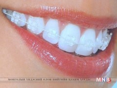 Шүд сүйтгэх таван үйлдэл 