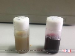 Монгол хүний хавдрын эсийн санг бий болгоно 