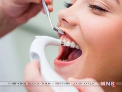 “Эрүүл шүд-эрүүл хүүхэд” үндэсний хөтөлбөр нээлтээ хийнэ