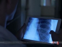 Сүрьеэгийн өвчлөлийн шинэ тохиолдол жил бүр нэмэгдсээр байна