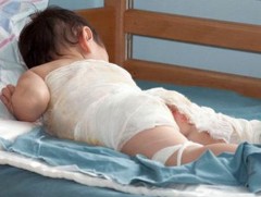 Ахуйн түлэгдэлтээр өдөрт 20-30 хүүхэд ГССҮТ-д хандаж байна 