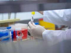 Орхон аймаг нийт хүн амынхаа 14.6 хувийг шинжилгээнд хамруулаад байна