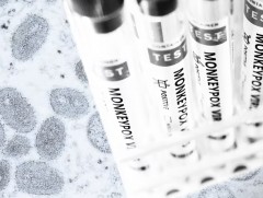 Сармагчны цэцэг өвчин 19 улсад 131 тохиолдол батлагджээ  