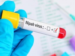 ДЭМБ: Нипахвирусын халдвар Энэтхэгээс хальж тархах эрсдэл бага