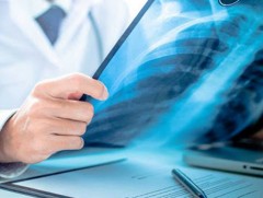 Нийслэлийн Баянзүрх, Хан-Уул дүүрэгт сүрьеэгийн илрүүлэлтийн үйл ажиллагааг маргааш эхлүүлнэ