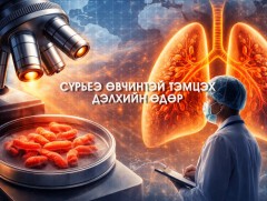 ӨНӨӨДӨР: Сүрьеэ өвчинтэй тэмцэх дэлхийн өдөр